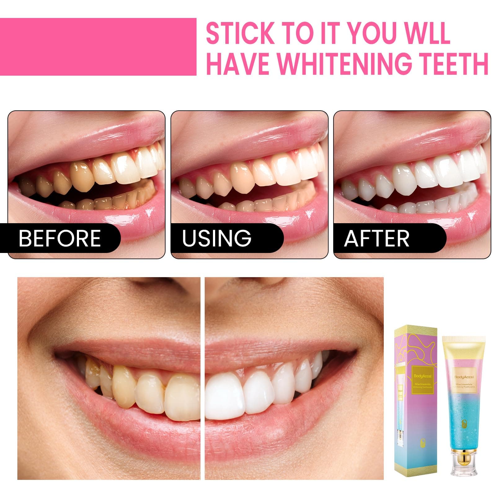 Eptchn Niacinamide Whitening Toothpaste